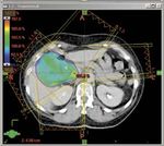 2008 09 Radio-Onkologiezentrum Biel-Seeland-Berner Jura Centre de radio-oncologie Bienne-Seeland-Jura Bernois