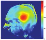 Warum 7-Tesla-1-H-MRT im Gehirn? - Speck O www.kup.at/ - Krause und Pachernegg
