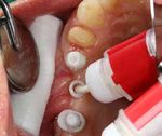 SDS Swiss Dental Solutions - PROTHETIKHANDBUCH