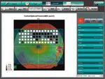 Kowa AP-7000 Autoperimeter für statische und kinetische Perimetrie - www.kowamedical.com/de