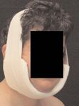 Lymphologischer Kompressions-verband bei Kopf-, Brust- und Genitallymphödem unter ambulanten Bedingungen