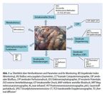 Neuromonitoring Burkhard Simma Traunseeklausur Gmunden