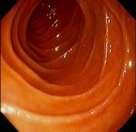 Nahrungsmittel-Allergien-Nahrungsmittel-Intoleranzen - Labors.at