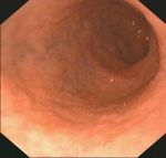 Nahrungsmittel-Allergien-Nahrungsmittel-Intoleranzen - Labors.at