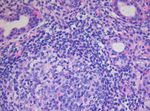 Update : Lupus und Sj&ouml;gren - Prof.M.Seitz RIA Universit&auml;tsklinik f&uuml;r Rheumatologie, Immunologie und Allergologie