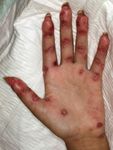 Update : Lupus und Sj&ouml;gren - Prof.M.Seitz RIA Universit&auml;tsklinik f&uuml;r Rheumatologie, Immunologie und Allergologie