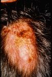 Update : Lupus und Sj&ouml;gren - Prof.M.Seitz RIA Universit&auml;tsklinik f&uuml;r Rheumatologie, Immunologie und Allergologie