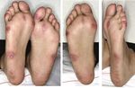 Update : Lupus und Sj&ouml;gren - Prof.M.Seitz RIA Universit&auml;tsklinik f&uuml;r Rheumatologie, Immunologie und Allergologie