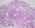 Update : Lupus und Sj&ouml;gren - Prof.M.Seitz RIA Universit&auml;tsklinik f&uuml;r Rheumatologie, Immunologie und Allergologie