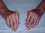 Update : Lupus und Sj&ouml;gren - Prof.M.Seitz RIA Universit&auml;tsklinik f&uuml;r Rheumatologie, Immunologie und Allergologie