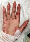 Update : Lupus und Sj&ouml;gren - Prof.M.Seitz RIA Universit&auml;tsklinik f&uuml;r Rheumatologie, Immunologie und Allergologie