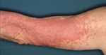 Update : Lupus und Sj&ouml;gren - Prof.M.Seitz RIA Universit&auml;tsklinik f&uuml;r Rheumatologie, Immunologie und Allergologie