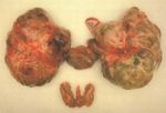 Klinische Chemie und Laboratoriumsdiagnostik - Vorlesung: Schilddr&uuml;sendiagnostik