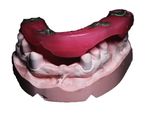 Zahnfarbene Kunststoffe als Gerüstmaterialien bei abnehmbarem Zahnersatz - ePaper