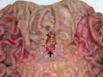 Helicobacter pylorineue Therapieempfehlungen - Christoph H&ouml;genauer Theodor Escherich Labor f&uuml;r Mikrobiomforschung - infektiologie.co.at