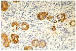 Helicobacter pylorineue Therapieempfehlungen - Christoph H&ouml;genauer Theodor Escherich Labor f&uuml;r Mikrobiomforschung - infektiologie.co.at