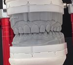 Kiefergelenksvermessung im digitalen Workflow - Dental ...