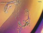 Kontaktlinsen-Oberflächen im digitalen Phasen-Kontrast-Mikroskop