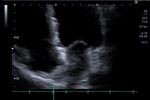Kopfschmerzen und arterielle Hypertonie - Herr D, 48-j&auml;hrig