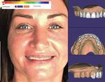 Digitales Smile Design: Sieben Veneers an einem Tag - ePaper