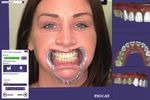 Digitales Smile Design: Sieben Veneers an einem Tag - ePaper