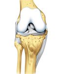 Wir sorgen für Sie. Steigerwaldklinik Burgebrach - Orthopädische Chirurgie Zentrum für Endoprothetik - GKG ...