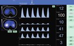PulmoVista 500 Respiratorisches Monitoring am Patientenbett: Dräger