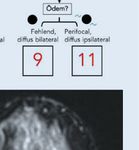 Künstliche Intelligenz in der Mammadiagnostik - Anwendungsgebiete aus klinischer Perspektive