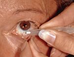 Kataraktchirurgie - patientengerechte Implantate - Das Auge war das Organ, womit ich die Welt fasste", Johann Wolfgang von Goethe (1749 -1832) ...