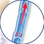 DIE OPTIMALE THERAPIE BEIM OFFENEN BEIN - RATGEBER FÜR PATIENTEN - HWX ...