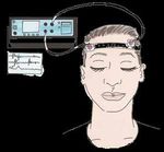 DER NACHGEWIESENE ERFOLG - Zentrum für Neurostimulation - Katholisches Krankenhaus Hagen