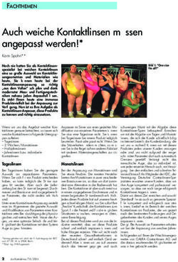 Auch weiche Kontaktlinsen m&uuml;ssen angepasst werden!