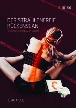 DER STRAHLENFREIE RÜCKENSCAN - IDIAG M360 - EINFACH, SCHNELL, PRÄZISE - Idiag AG