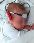 Bewährte Technologie. Überragende Leistung - ALGO 7i Neugeborenen-Hörscreener - Eumedics
