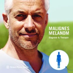 MALIGNES MELANOM Diagnose & Therapie - Melanom-Wissen