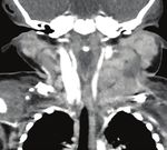 Der Weg zu erfolgreichen Untersuchungen in der onkologischen Diagnostik - Philips