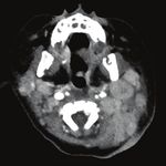 Der Weg zu erfolgreichen Untersuchungen in der onkologischen Diagnostik - Philips