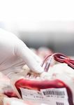 Diagnostik im Dialog der Roche Diagnostics Deutschland GmbH - Aktuelle Herausforderungen der Transfusionsmedizin