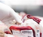 Diagnostik im Dialog der Roche Diagnostics Deutschland GmbH - Aktuelle Herausforderungen der Transfusionsmedizin