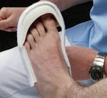Total Contact Cast: Effektiv in der Behandlung Diabetischer Fußulzera