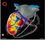 Neu in der Kardiologie - Rhythmologie